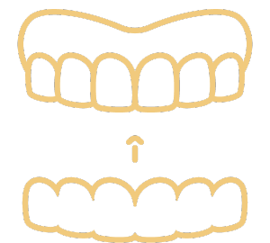 Invisalign