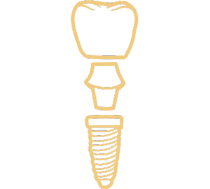 Implants