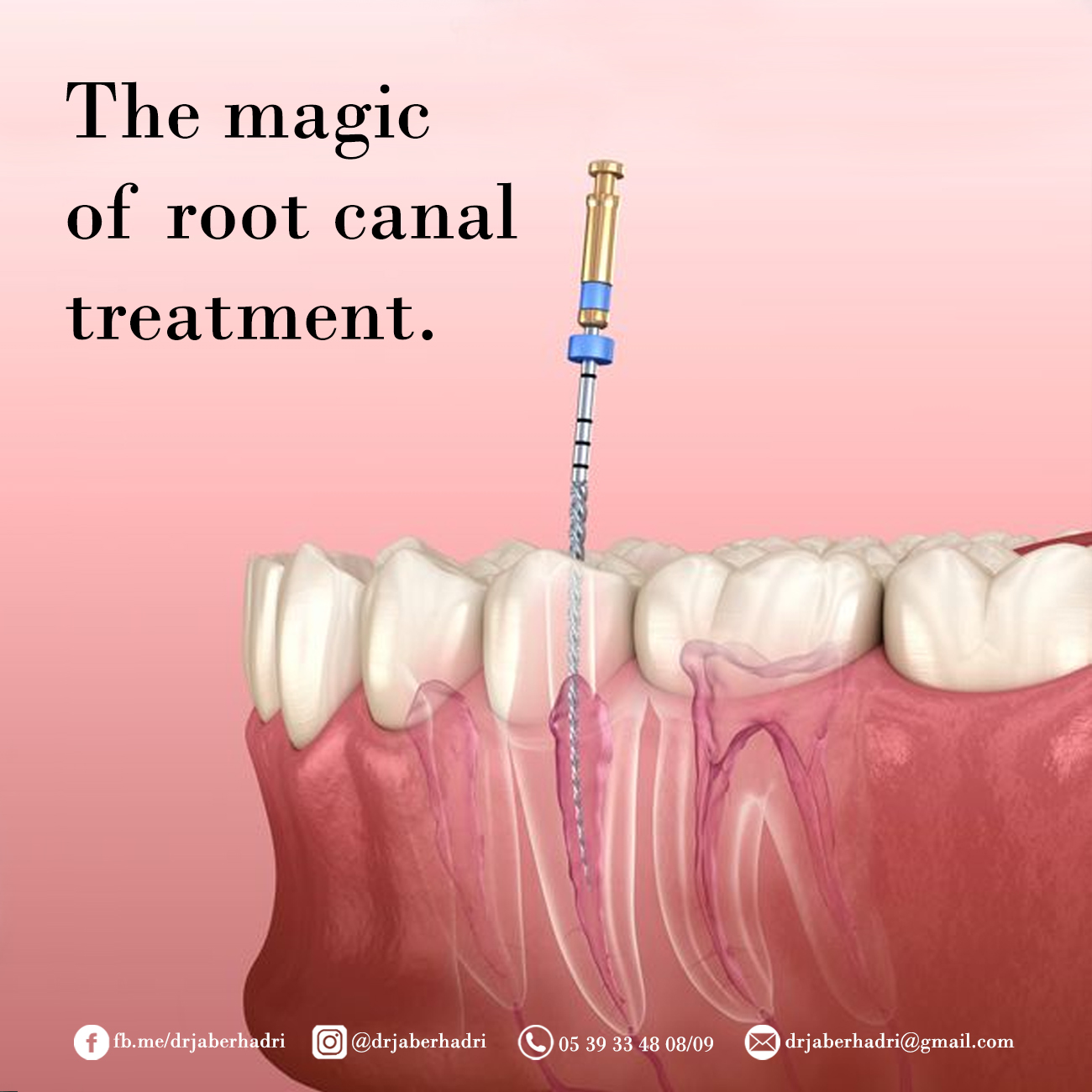 Traitement endo